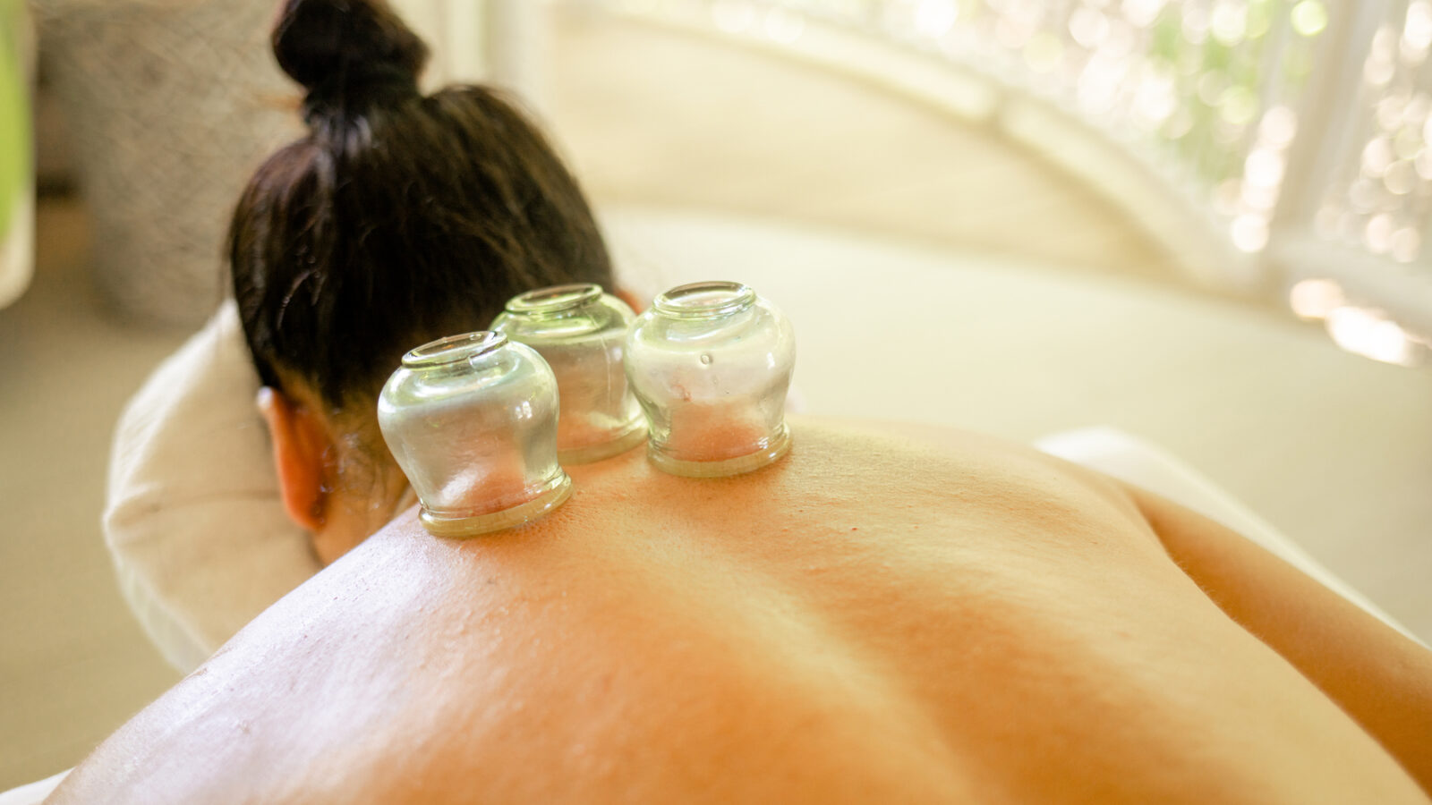 A person receiving cupping therapy lies facedown. Three glass cups are placed on their back. The room has a soft, natural light filtering through a window, creating a serene atmosphere.